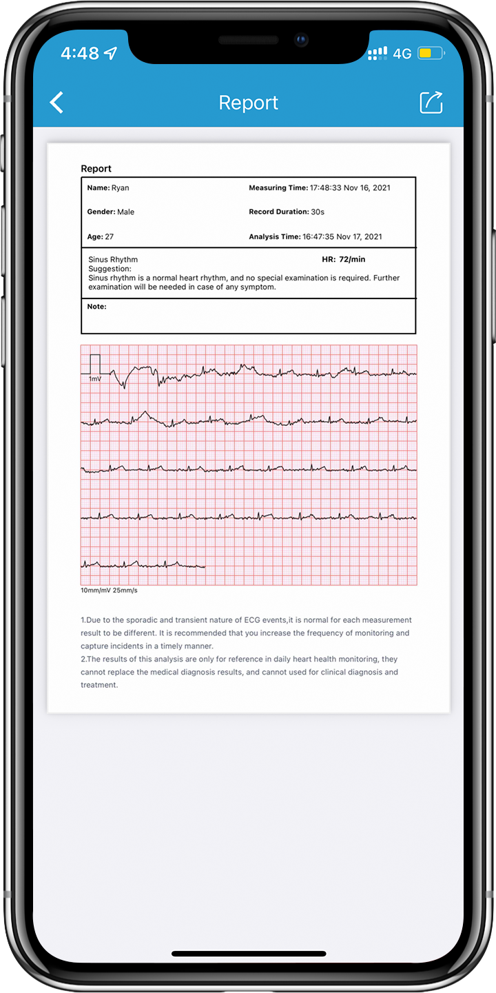 Bluetooth  BP2 WIFI  AI Analysis Upper Arm Digital EKG Blood Pressure Monitor