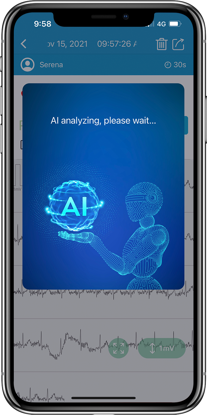 Bluetooth  BP2 WIFI  AI Analysis Upper Arm Digital EKG Blood Pressure Monitor