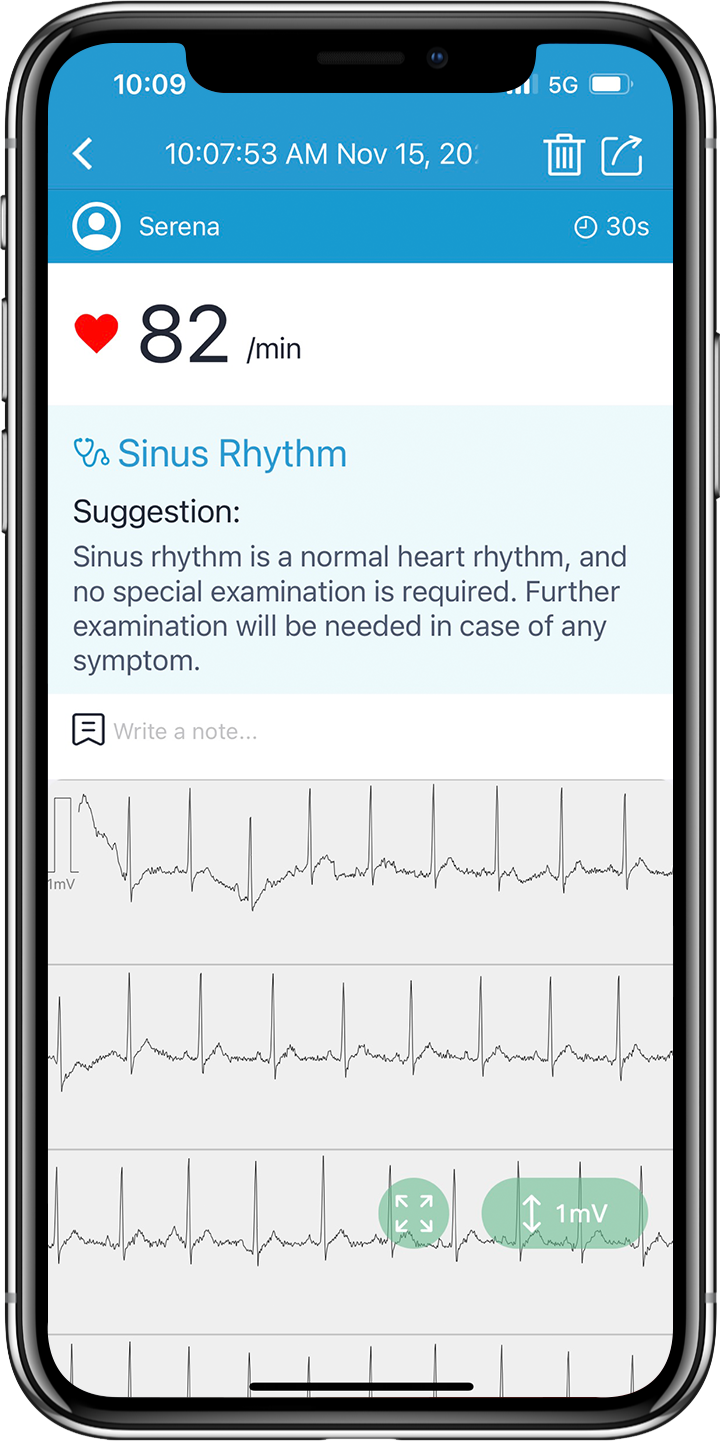 Bluetooth  BP2 WIFI  AI Analysis Upper Arm Digital EKG Blood Pressure Monitor