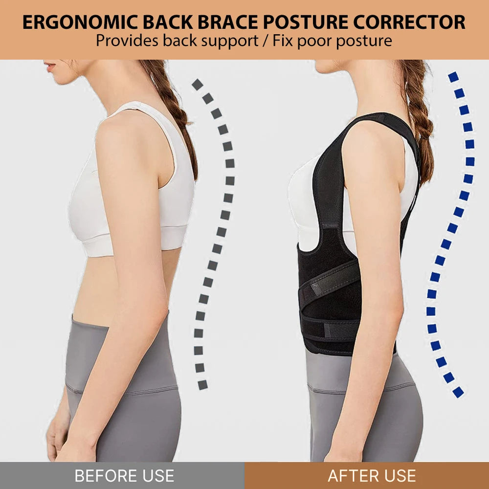 Back Brace and Posture Corrector for Men and Women, Back Straightener Posture Corrector Scoliosis & Hunchback Correction Support