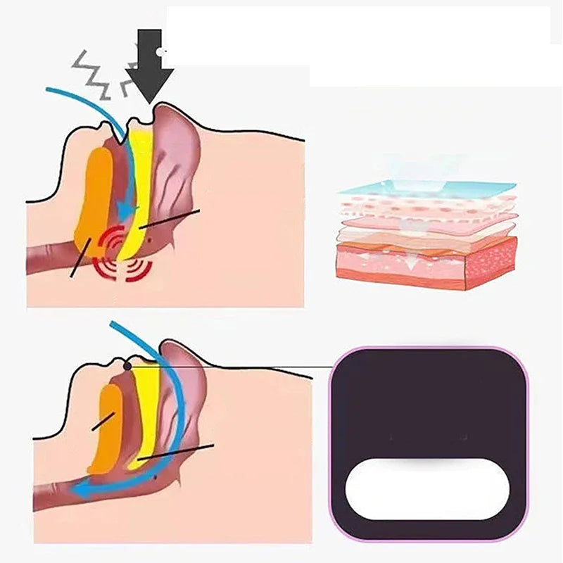 Premium Anti-Snoring Mouth Stickers - Sleep Quality Solution for Adults & Children