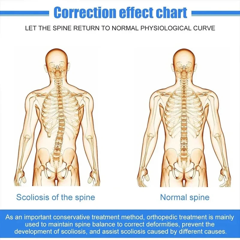 1Set Fixed Spinal Brace Aluminium Alloy Breathable Fixed Spinal Straightener Brace for Children Adults Scoliosis Correcting Brac