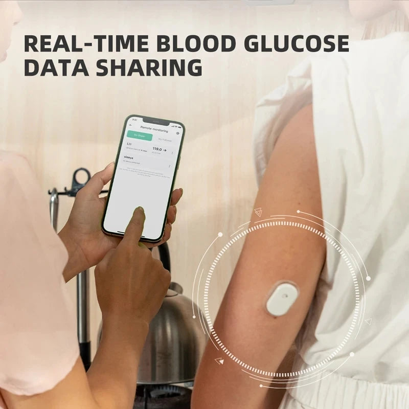 Aidex Dynamic Blood Glucose Monitoring